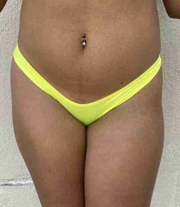 Basic Neon Yellow Low Rise Scrunch Back Bottoms
